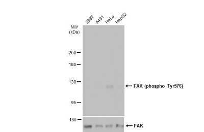 Western Blot: FAK [p Tyr576] Antibody [NBP3-13071]